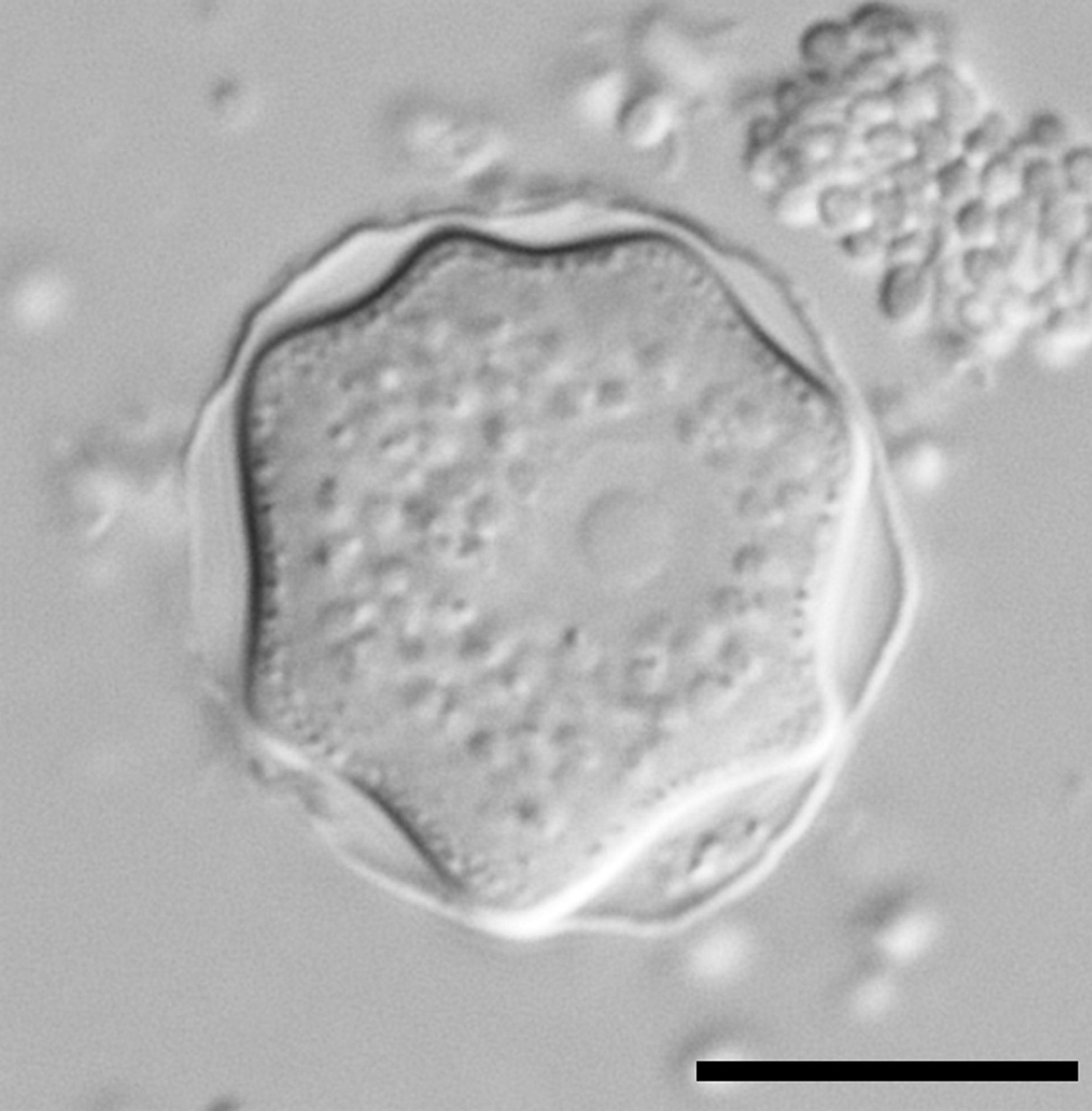 Interference contrast micrograph of an Acanthamoeba cyst with thick double wall