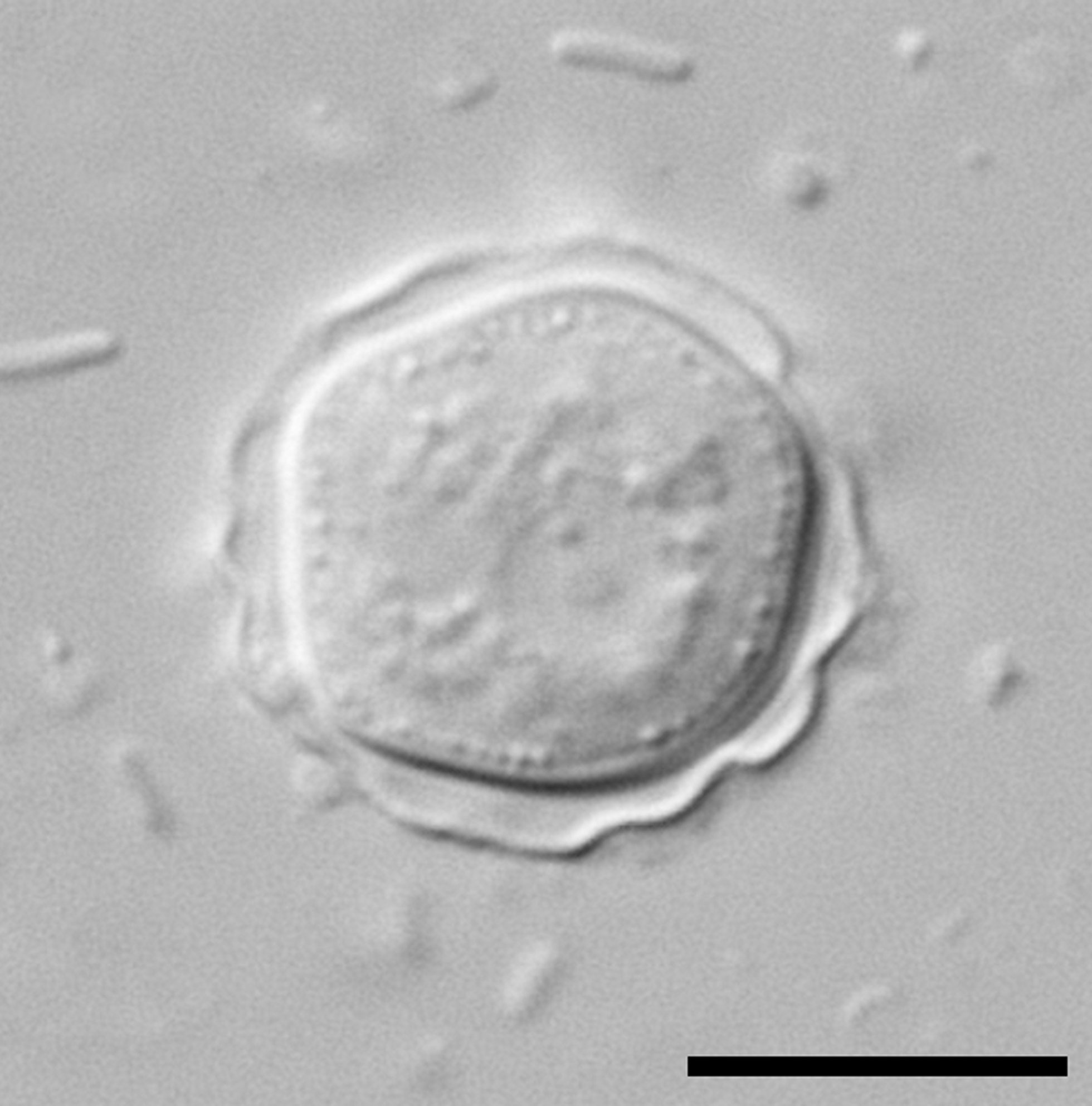 Interference contrast micrograph of an Acanthamoeba cyst with layered wall
