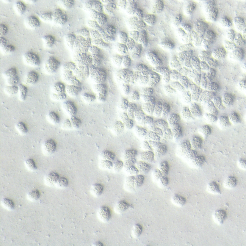 Light microscopy image of numerous Acanthamoeba trophozoites in culture