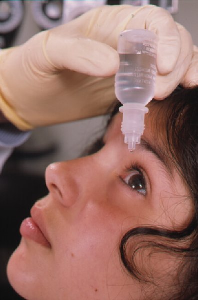 Act of placing an eye drop into the eye