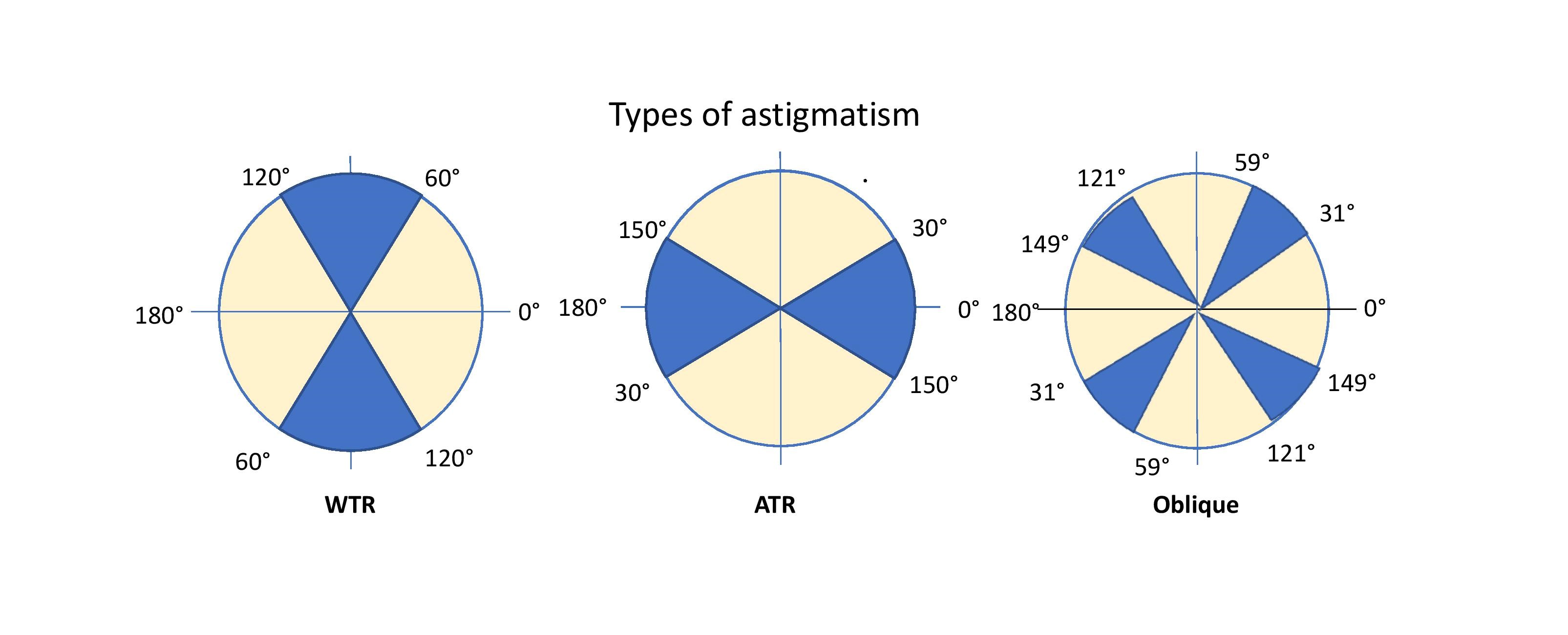 Illustration comparing with-the-rule, against-the-rule, and oblique astigmatism axes