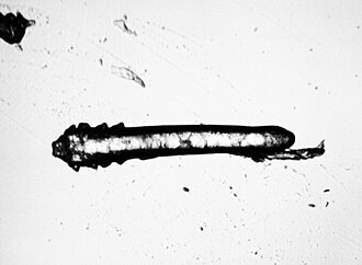 Microscopic image of Demodex folliculorum mite.