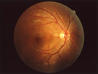 Color fundus photograph of a normal human retina