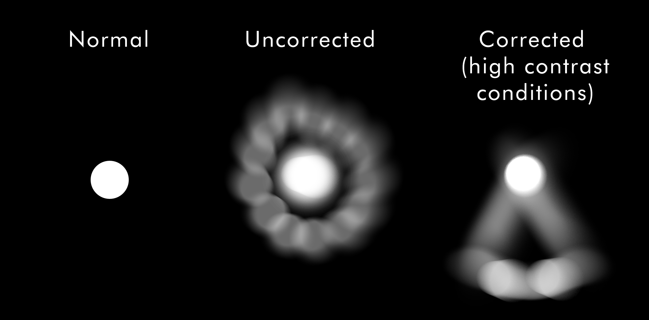 Side-by-side vision simulation of normal sight versus keratoconus blur and ghosting