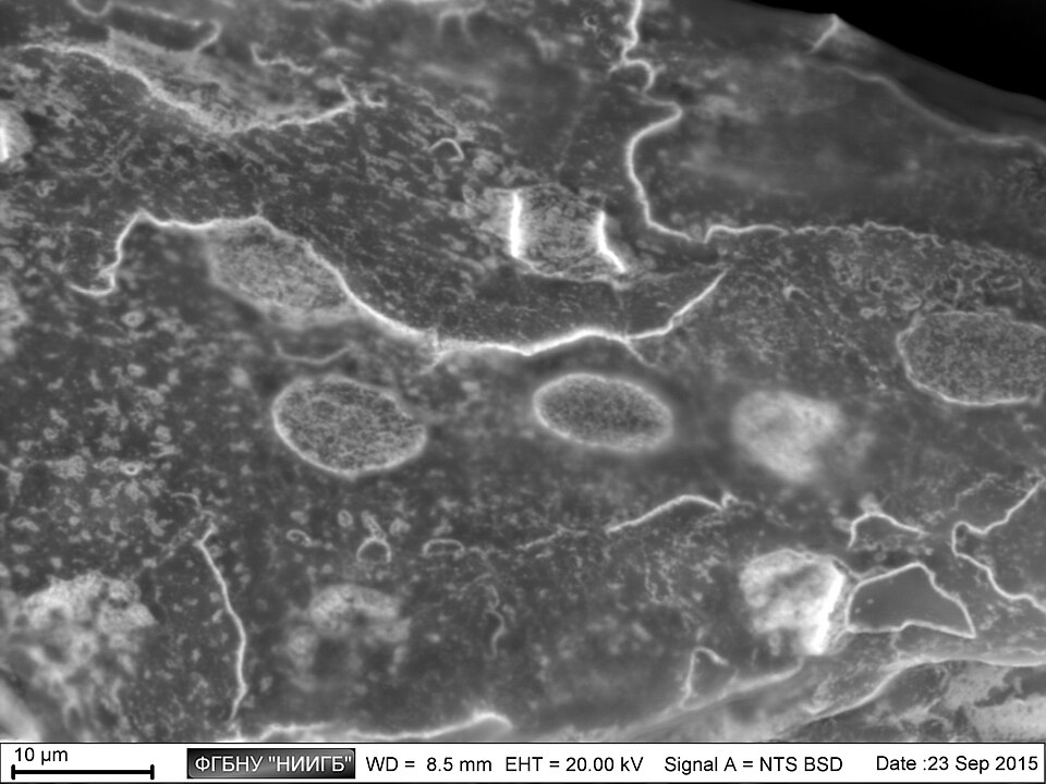 Scanning electron micrograph of human corneal epithelium