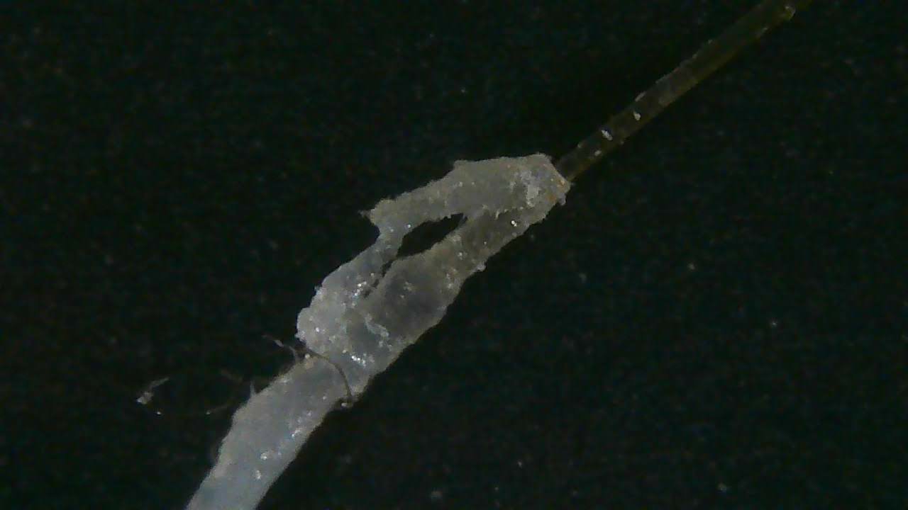 Microscope image showing Demodex and collarette material along a hair shaft