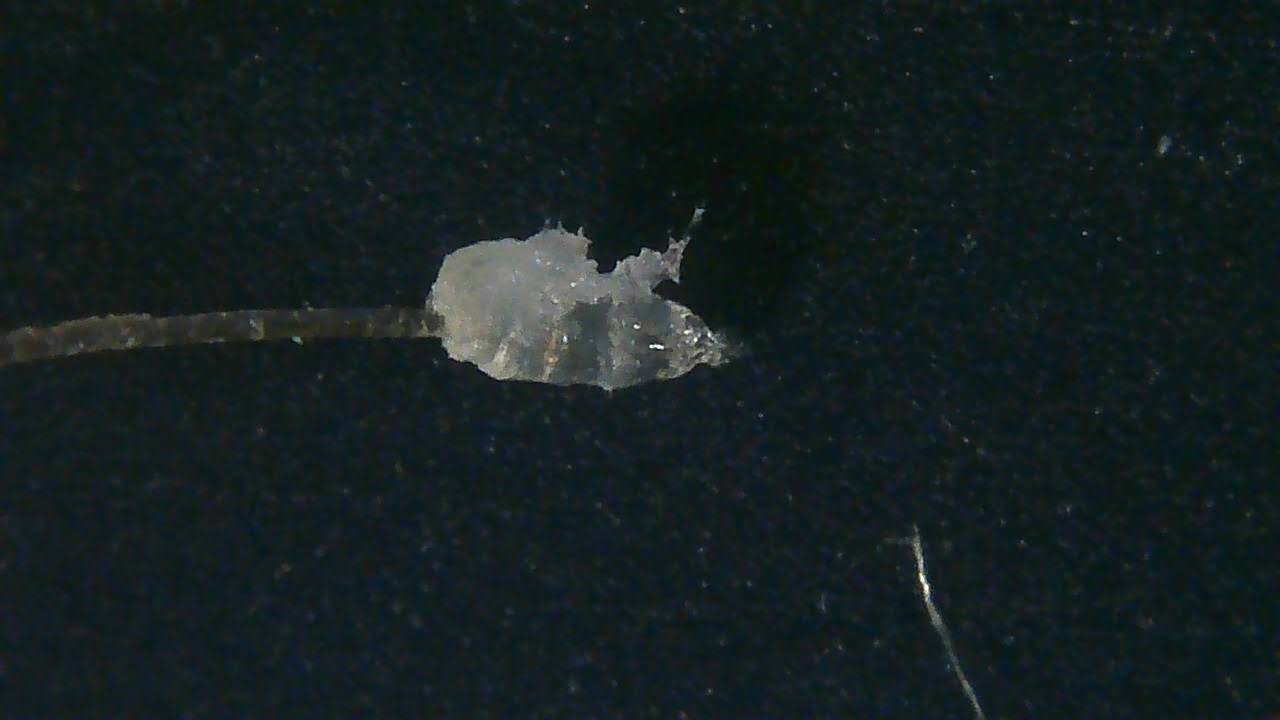 Microscope image of a Demodex mite attached to a hair follicle