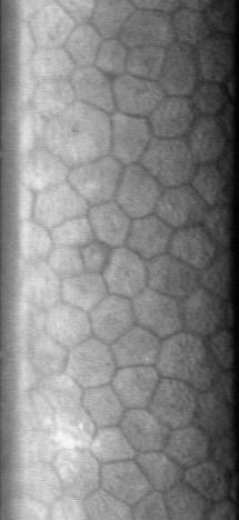 Specular microscopy image demonstrating hexagonal corneal endothelial cells.