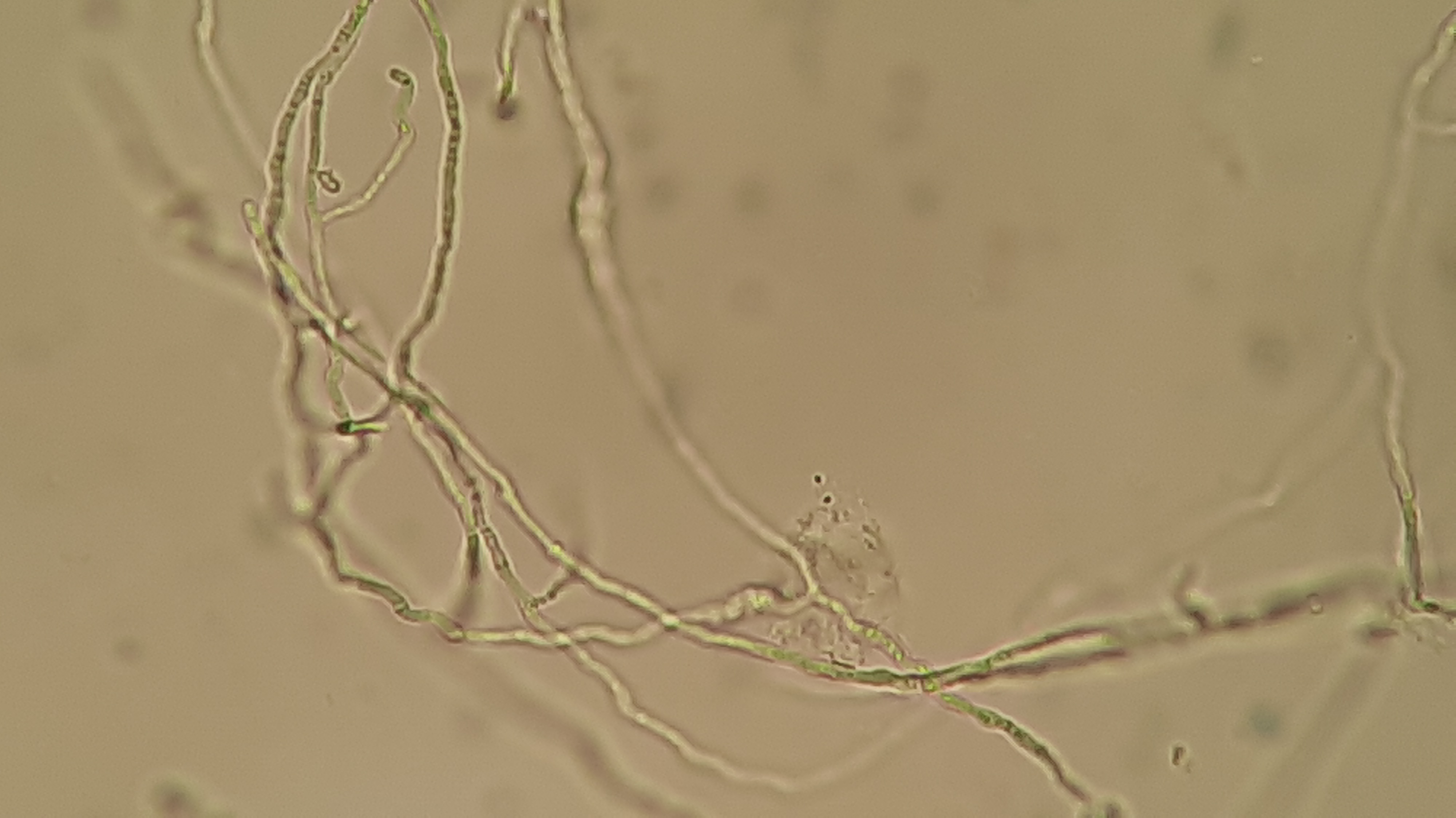 Microscopy showing branching fungal hyphae on a KOH mount