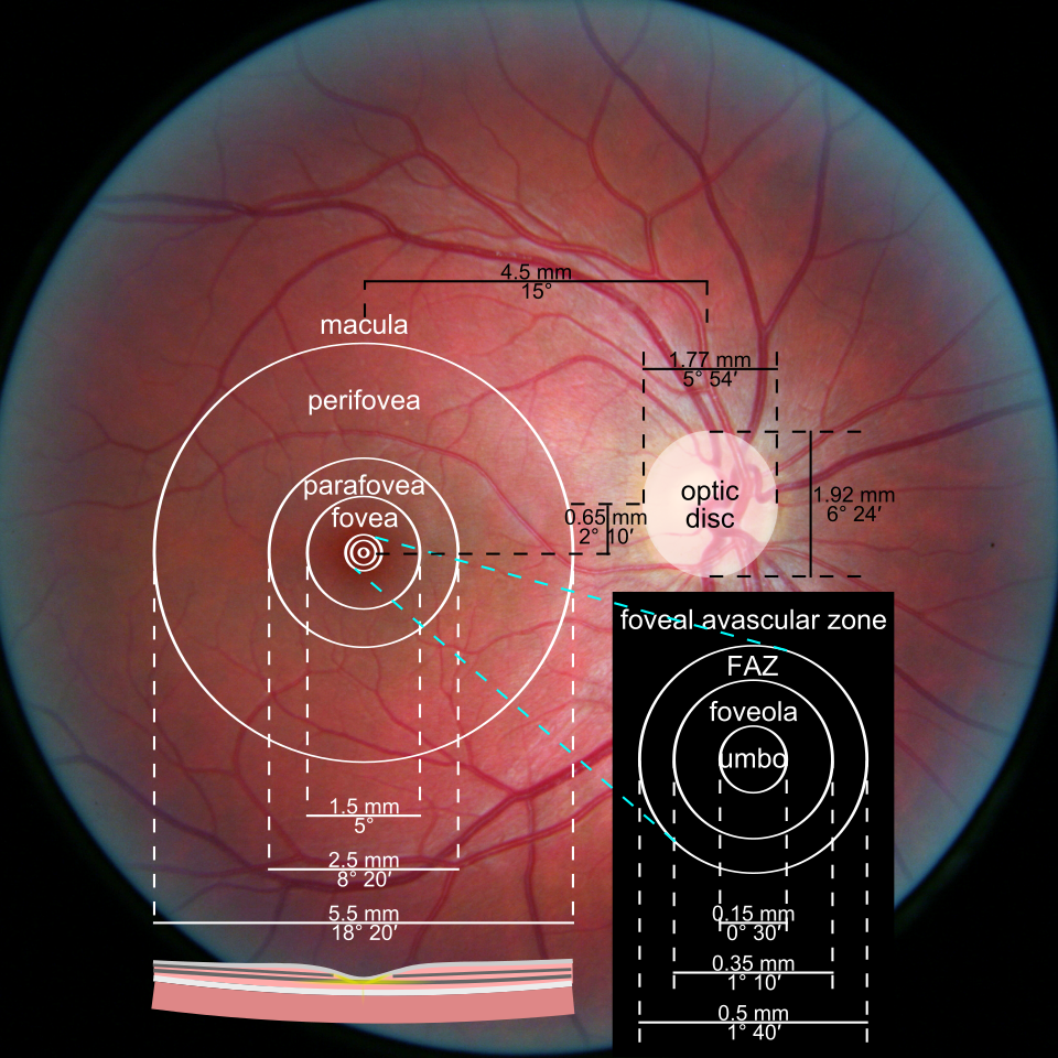 Diagram on a retinal photo showing the macula, fovea, and optic disc