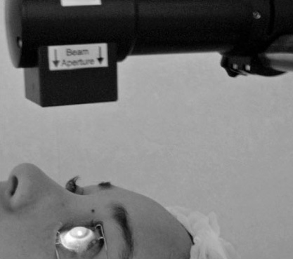 Patient undergoing corneal collagen cross-linking under a focused UV light source.