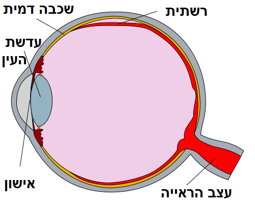 Cross-sectional diagram of an eye showing a detached retina