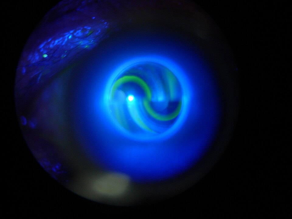 Fluorescein semicircular mires inside the tonometer prism