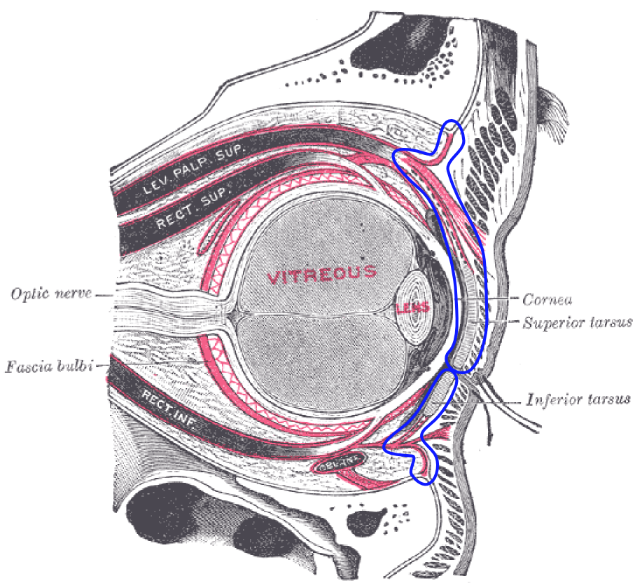 Sagittal view of the eye with the orbital septum outlined in blue.