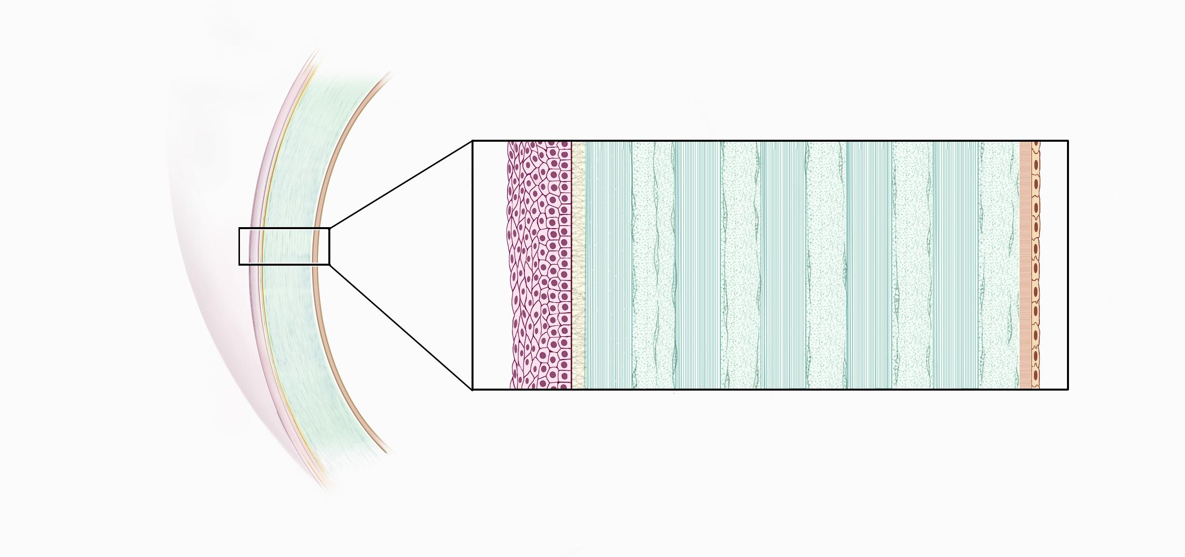 Magnified illustration of corneal epithelial layers removed during PRK