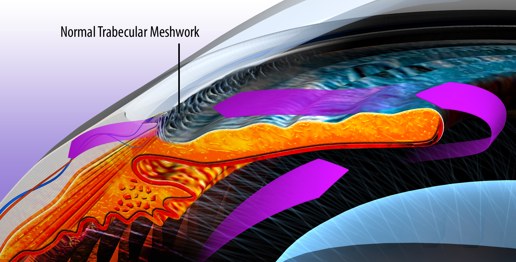 Illustration of aqueous fluid flowing through the trabecular meshwork in a healthy eye