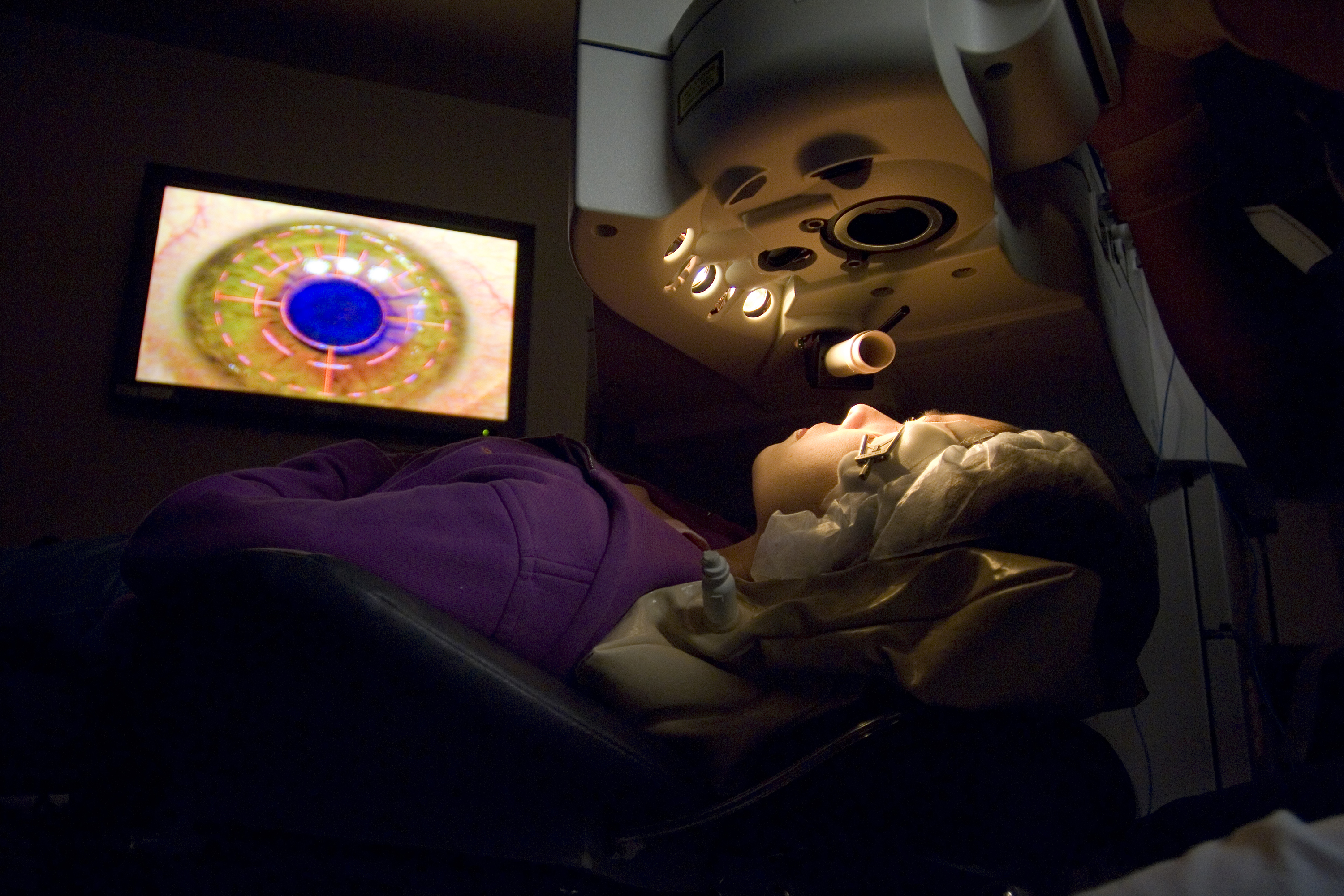 Patient undergoing LASIK laser eye surgery