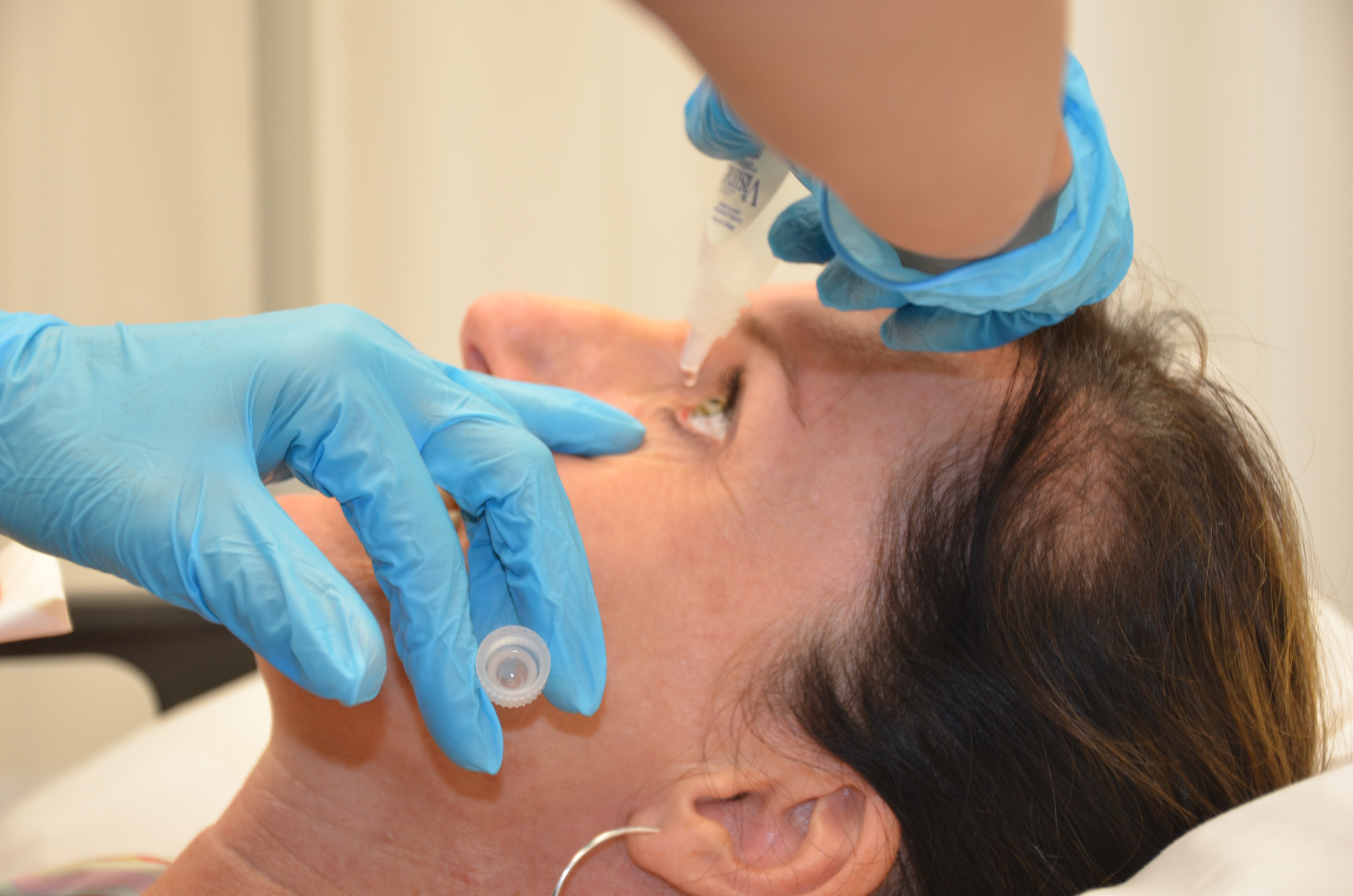 Person instilling eye medication from a dropper bottle