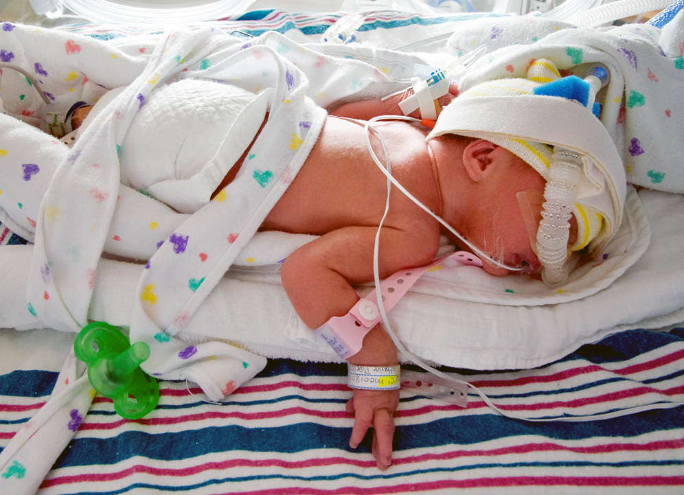 Premature infant in an incubator in the NICU with monitoring equipment