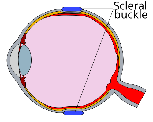 Cross-section diagram of the human eye