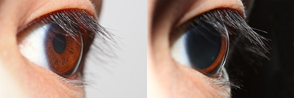 Side views showing constricted and dilated pupil in different light