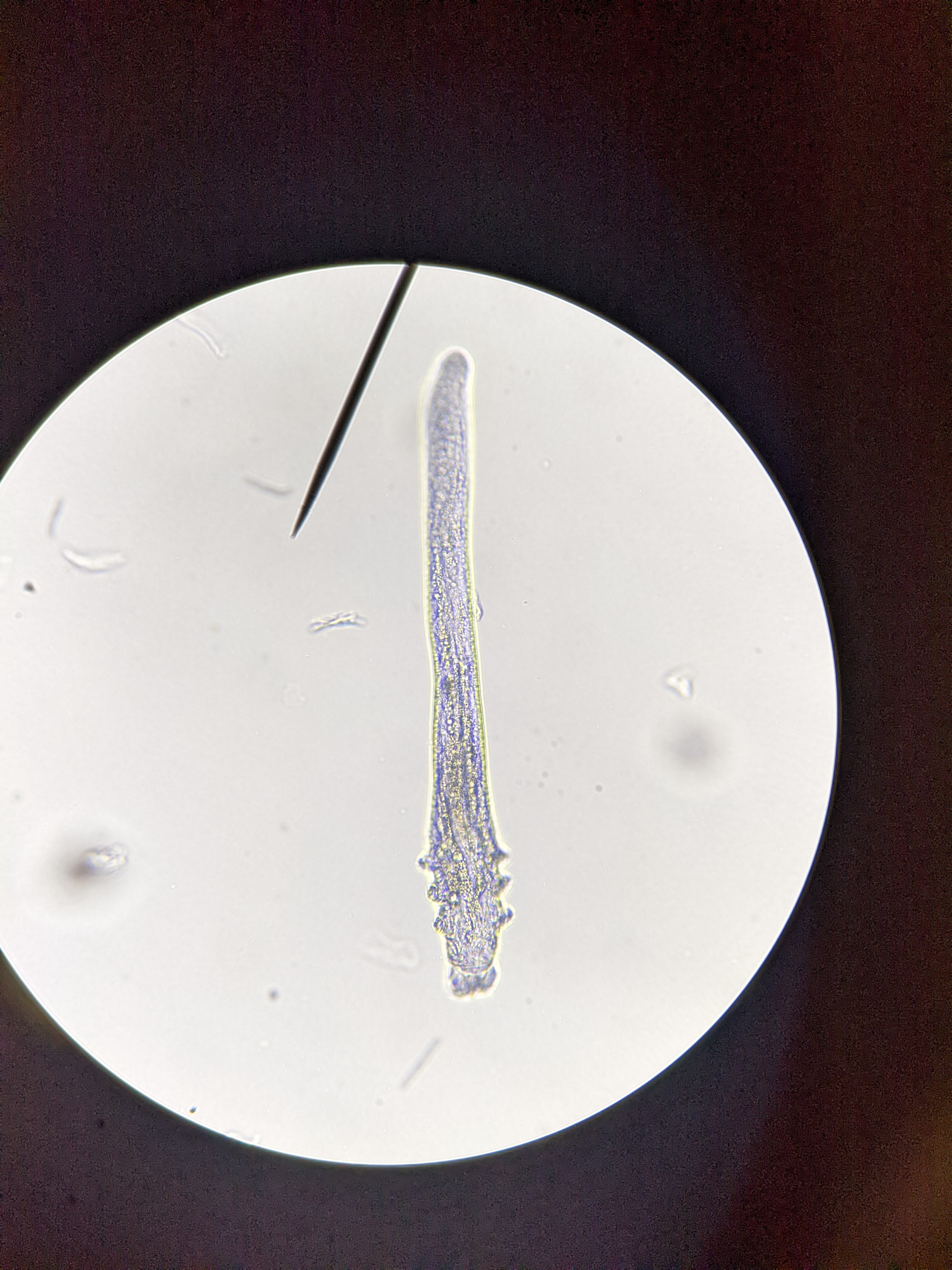 Demodex mite viewed through a microscope